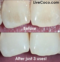 Teeth Cleaning Powder (Vitamins & Aloe Vera Infused)