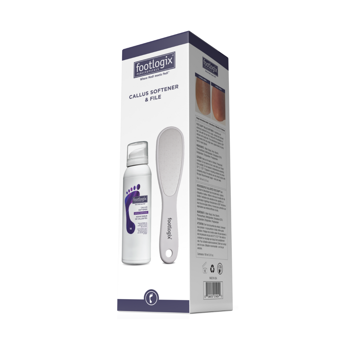 Footlogix Ultimate "At Home" Foot Care Combo (100ml)