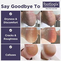 Footlogix Ultimate "At Home" Foot Care Combo (100ml)