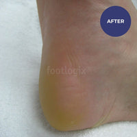 Footlogix Daily Maintenance Formula (125ml)